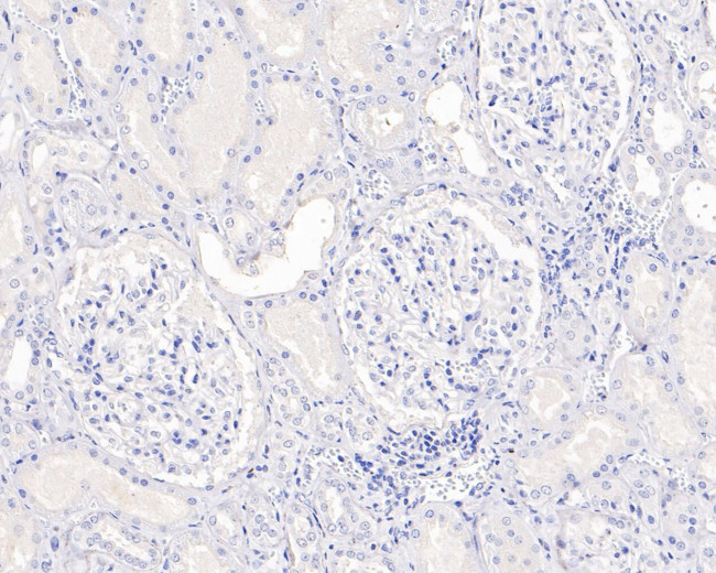 SOX10 Antibody in Immunohistochemistry (Paraffin) (IHC (P))