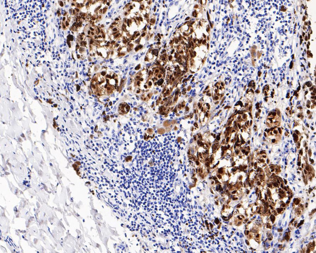 SOX10 Antibody in Immunohistochemistry (Paraffin) (IHC (P))