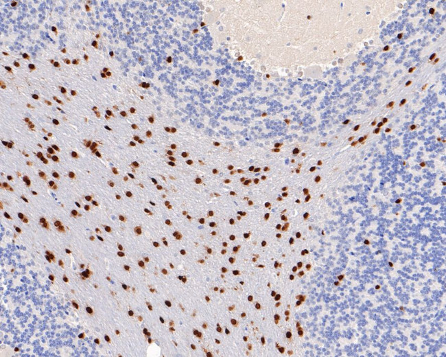 SOX10 Antibody in Immunohistochemistry (Paraffin) (IHC (P))