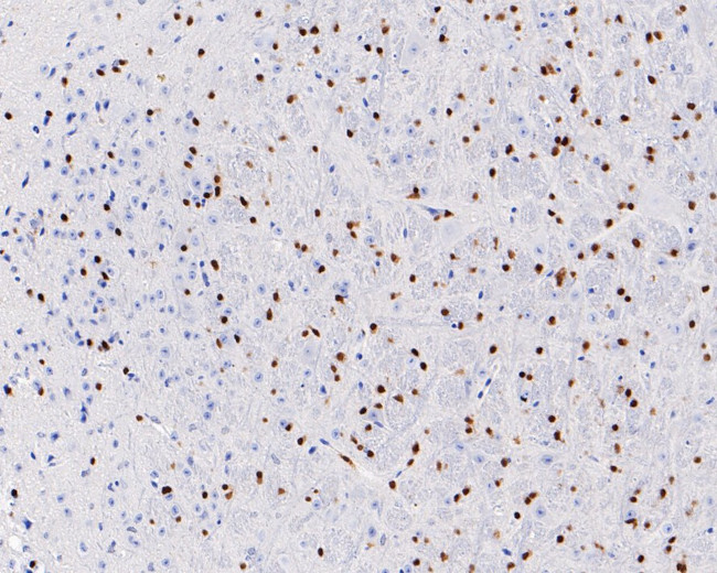 SOX10 Antibody in Immunohistochemistry (Paraffin) (IHC (P))