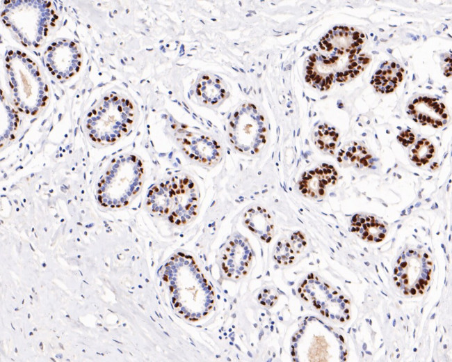 SOX10 Antibody in Immunohistochemistry (Paraffin) (IHC (P))