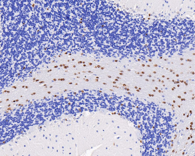 SOX10 Antibody in Immunohistochemistry (Paraffin) (IHC (P))