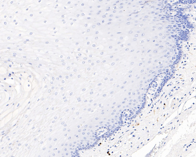 SOX10 Antibody in Immunohistochemistry (Paraffin) (IHC (P))