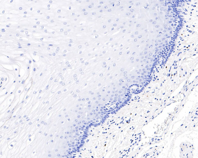 SOX10 Antibody in Immunohistochemistry (Paraffin) (IHC (P))