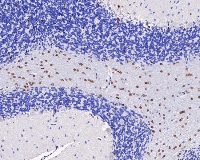 SOX10 Antibody in Immunohistochemistry (Paraffin) (IHC (P))