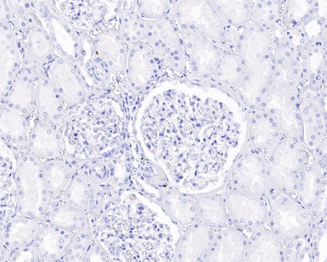 SOX10 Antibody in Immunohistochemistry (Paraffin) (IHC (P))