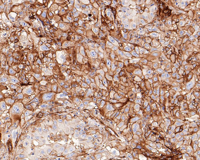 B7-H3 Antibody in Immunohistochemistry (Paraffin) (IHC (P))