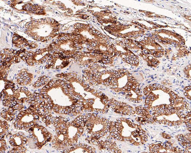 B7-H3 Antibody in Immunohistochemistry (Paraffin) (IHC (P))