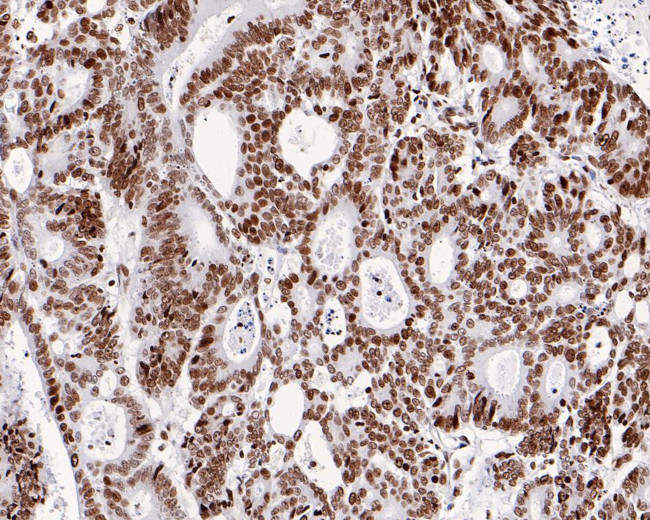 H4K8ac Antibody in Immunohistochemistry (Paraffin) (IHC (P))