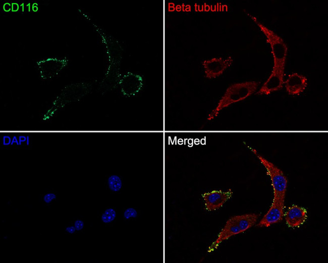 CD116 Antibody in Immunocytochemistry (ICC/IF)