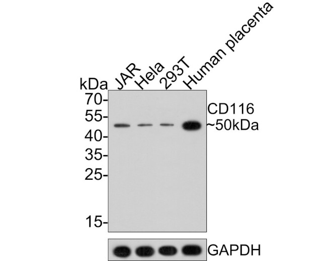 CD116 Antibody in Western Blot (WB)