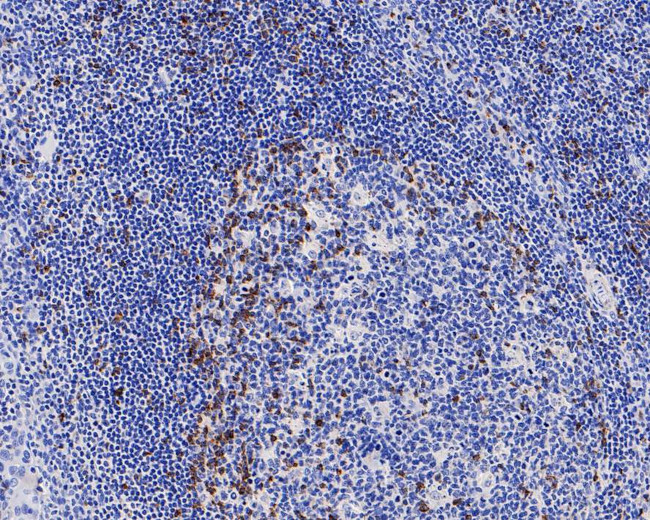 CTLA-4 Antibody in Immunohistochemistry (Paraffin) (IHC (P))
