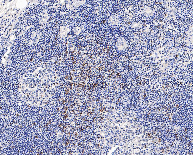 CTLA-4 Antibody in Immunohistochemistry (Paraffin) (IHC (P))