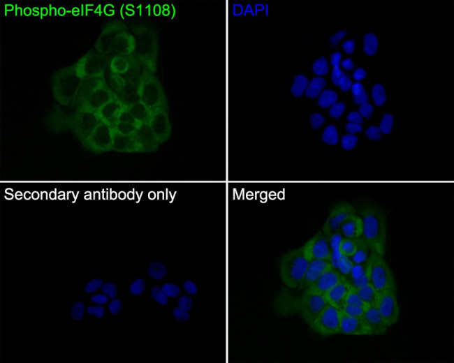 Phospho-eIF4G (Ser1108) Antibody in Immunocytochemistry (ICC/IF)