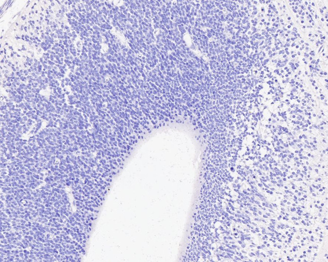 BrdU Antibody in Immunohistochemistry (Paraffin) (IHC (P))