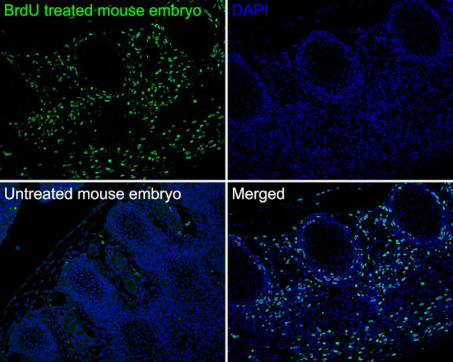 BrdU Antibody in Immunohistochemistry (Paraffin) (IHC (P))