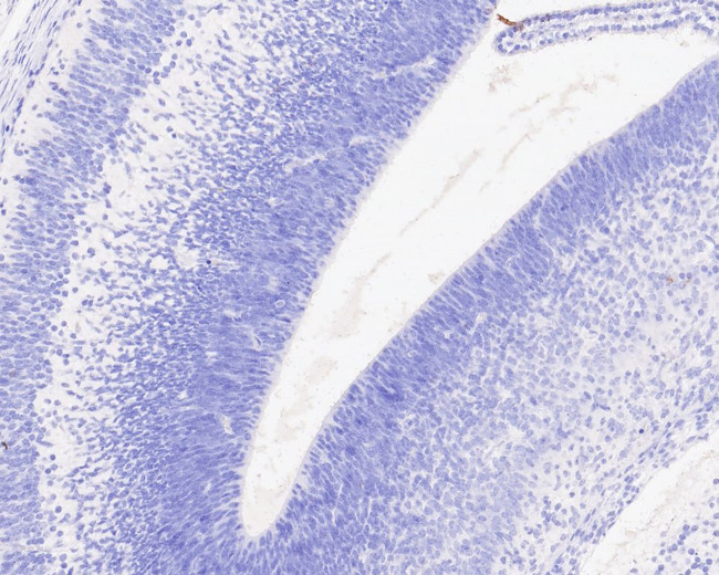 BrdU Antibody in Immunohistochemistry (Paraffin) (IHC (P))