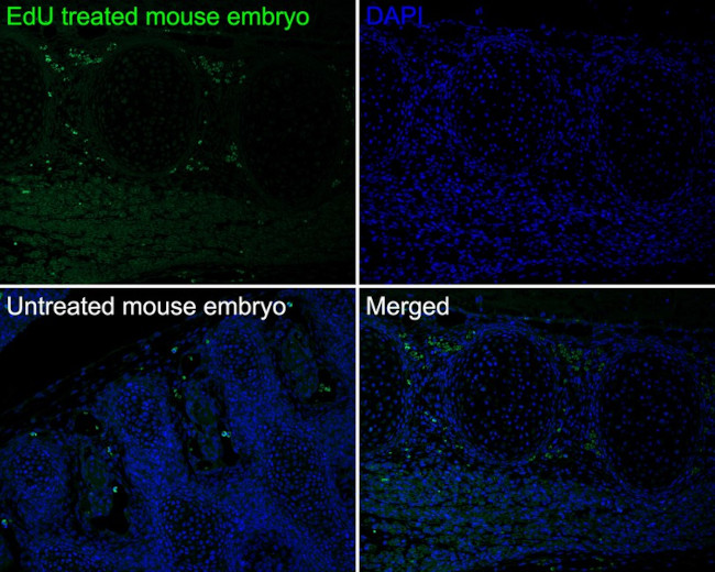 BrdU Antibody in Immunohistochemistry (Paraffin) (IHC (P))