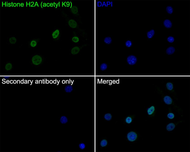 H2AK9ac Antibody in Immunocytochemistry (ICC/IF)