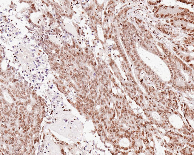 H2AK9ac Antibody in Immunohistochemistry (Paraffin) (IHC (P))