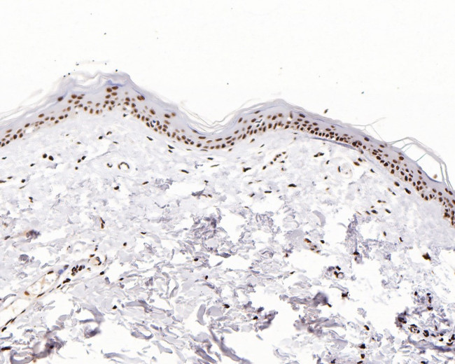 H2BK20ac Antibody in Immunohistochemistry (Paraffin) (IHC (P))