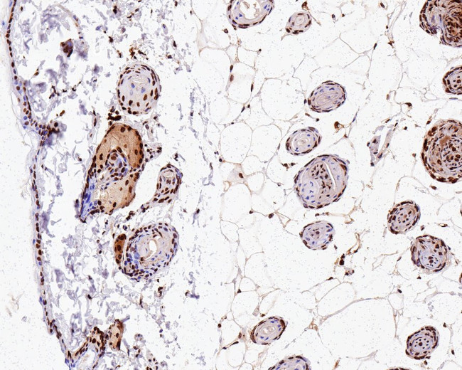 H2BK20ac Antibody in Immunohistochemistry (Paraffin) (IHC (P))