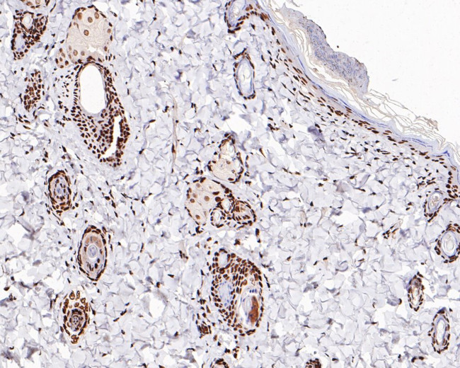 H2BK20ac Antibody in Immunohistochemistry (Paraffin) (IHC (P))