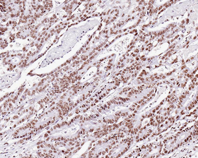 TRF2 Antibody in Immunohistochemistry (Paraffin) (IHC (P))