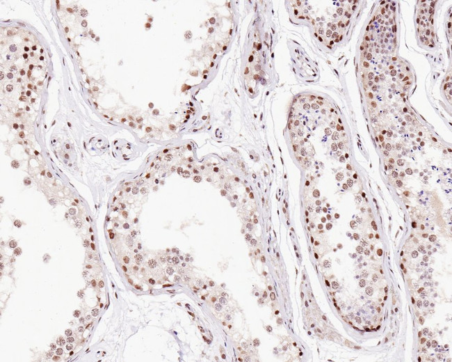 TRF2 Antibody in Immunohistochemistry (Paraffin) (IHC (P))