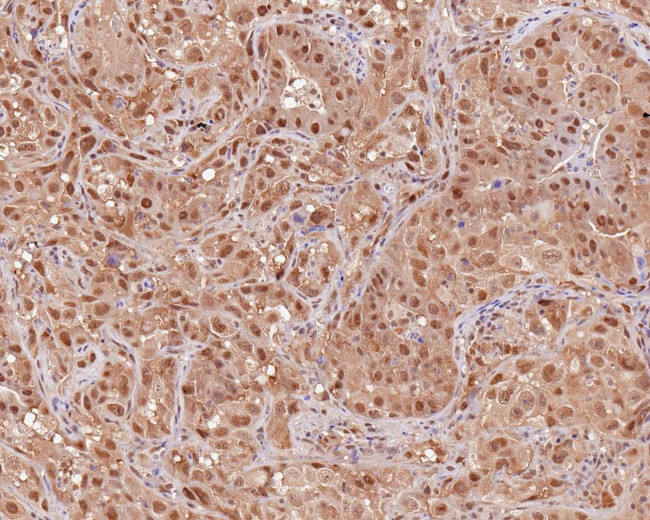 PSMC5 Antibody in Immunohistochemistry (Paraffin) (IHC (P))