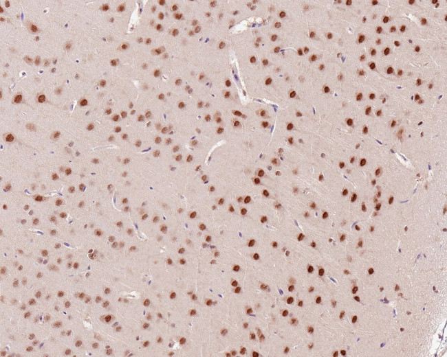 PSMC5 Antibody in Immunohistochemistry (Paraffin) (IHC (P))