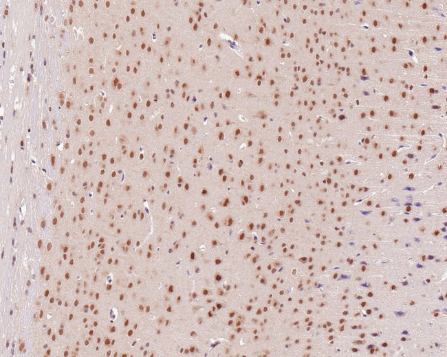 PSMC5 Antibody in Immunohistochemistry (Paraffin) (IHC (P))