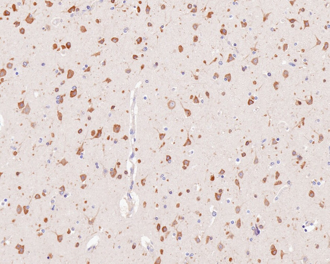 YTHDF1 Antibody in Immunohistochemistry (Paraffin) (IHC (P))