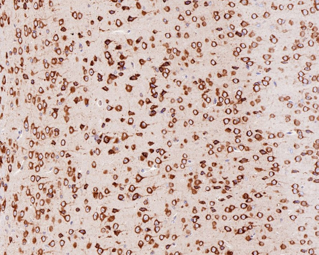 YTHDF1 Antibody in Immunohistochemistry (Paraffin) (IHC (P))