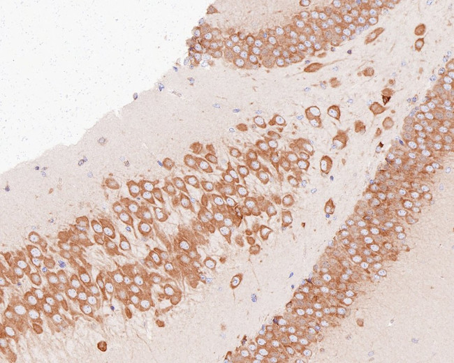 YTHDF1 Antibody in Immunohistochemistry (Paraffin) (IHC (P))