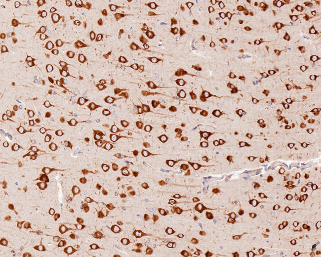 YTHDF1 Antibody in Immunohistochemistry (Paraffin) (IHC (P))