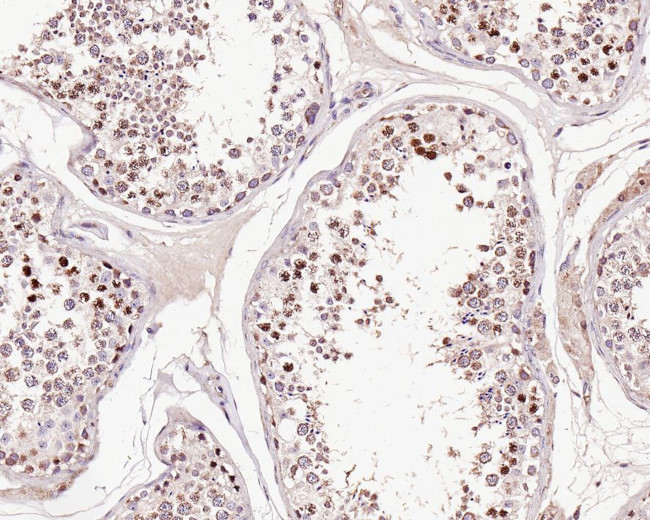 CDC6 Antibody in Immunohistochemistry (Paraffin) (IHC (P))