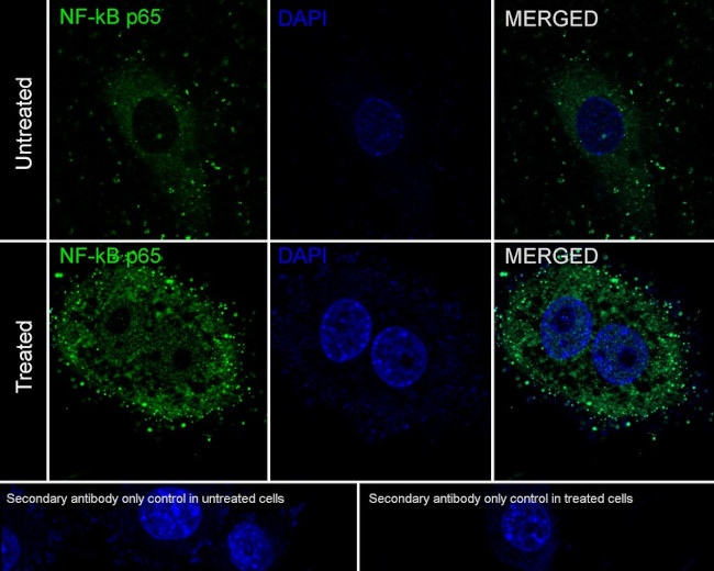 NFkB p65 Antibody in Immunocytochemistry (ICC/IF)