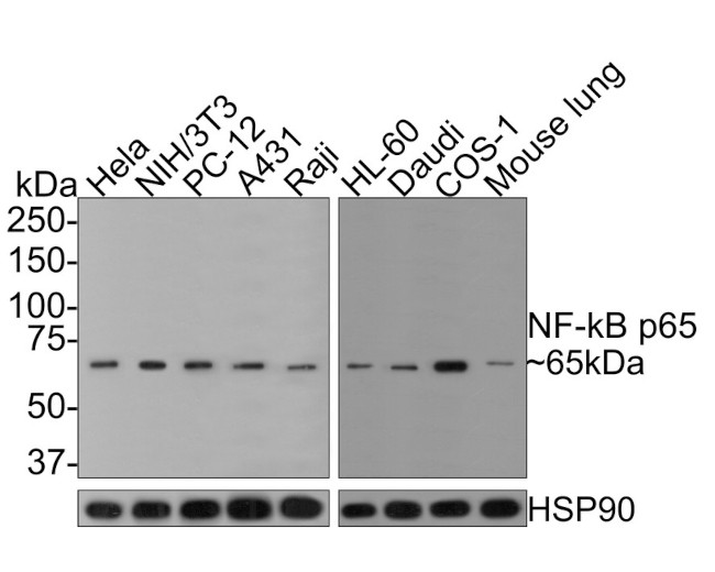 NFkB p65 Antibody in Immunohistochemistry (Paraffin) (IHC (P))