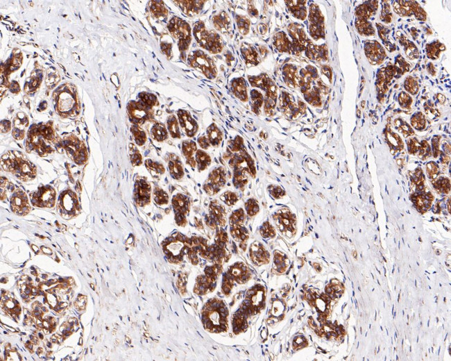 NFkB p65 Antibody in Western Blot (WB)