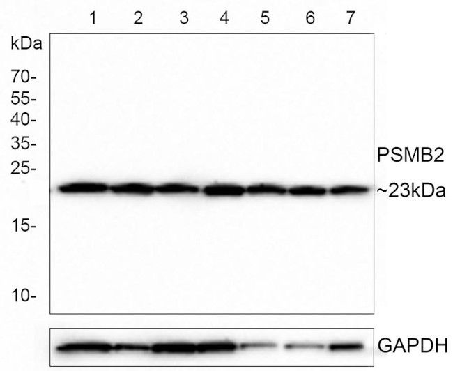 PSMB2 Antibody in Western Blot (WB)