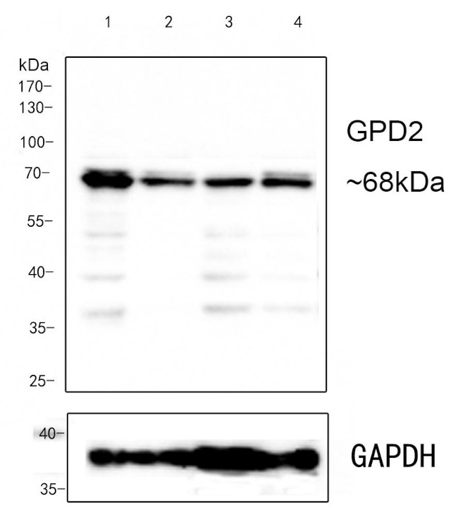 GPD2 Antibody in Western Blot (WB)