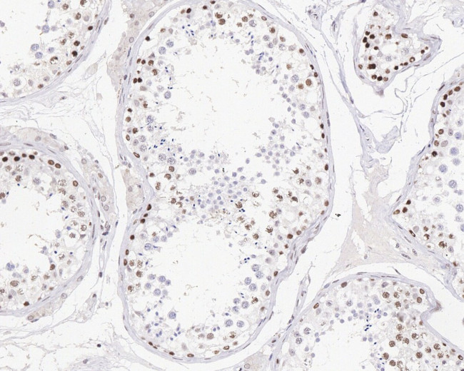 Menin Antibody in Immunohistochemistry (Paraffin) (IHC (P))