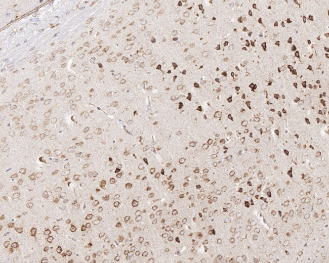 G3BP1 Antibody in Immunohistochemistry (Paraffin) (IHC (P))