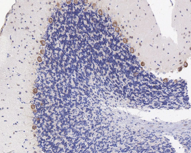 G3BP1 Antibody in Immunohistochemistry (Paraffin) (IHC (P))