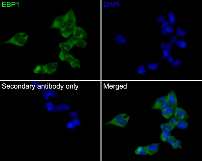 EBP1 Antibody in Immunocytochemistry (ICC/IF)