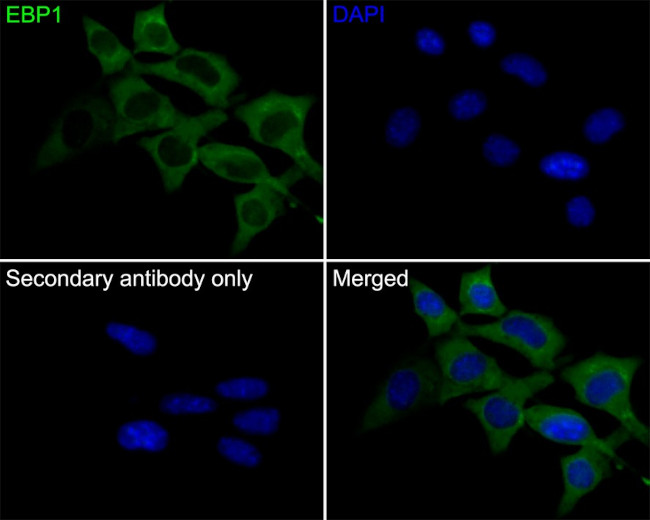 EBP1 Antibody in Immunocytochemistry (ICC/IF)