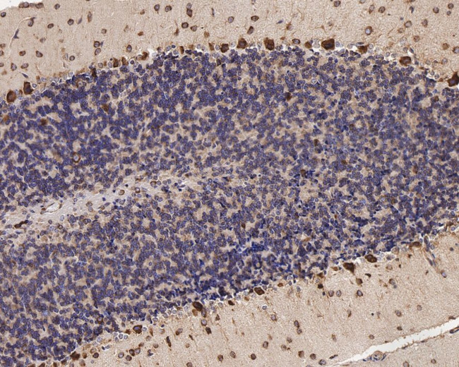 EBP1 Antibody in Immunohistochemistry (Paraffin) (IHC (P))