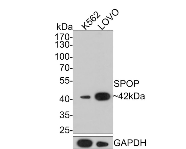 SPOP Antibody in Western Blot (WB)