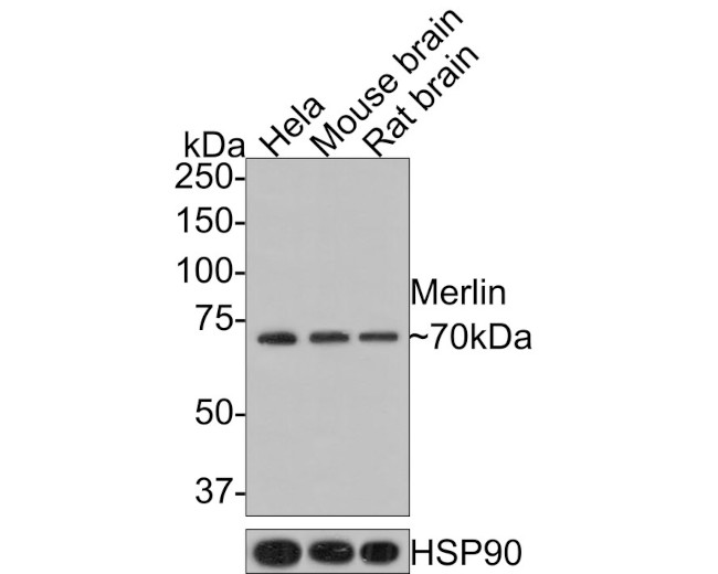 NF2 Antibody in Western Blot (WB)